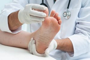Infecții fungice pe picioare – Simptome și tratament