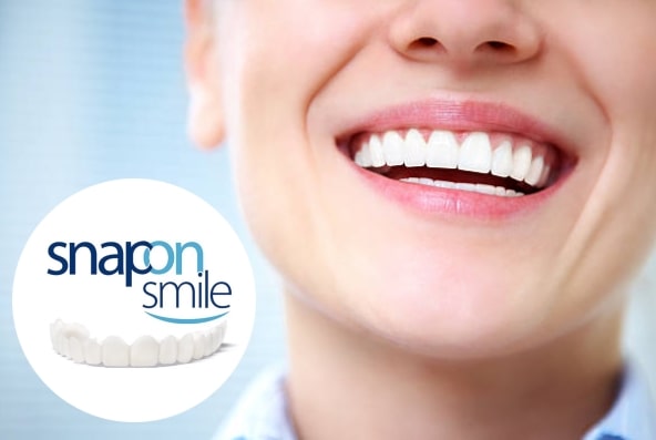 Snap-On Smile Pret in Romania